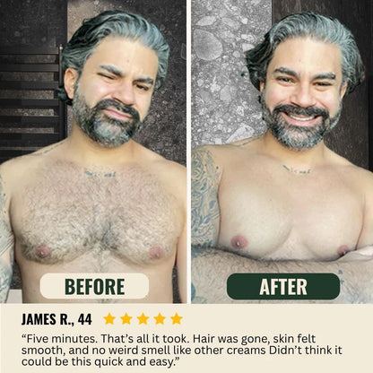 Valuethese  Hair Removal Cream