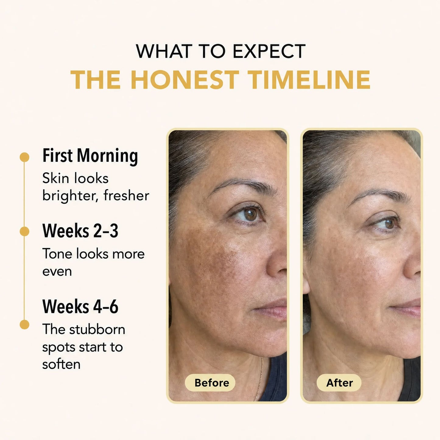 Valuethese Turmeric & Kojic Acid Overnight Mask