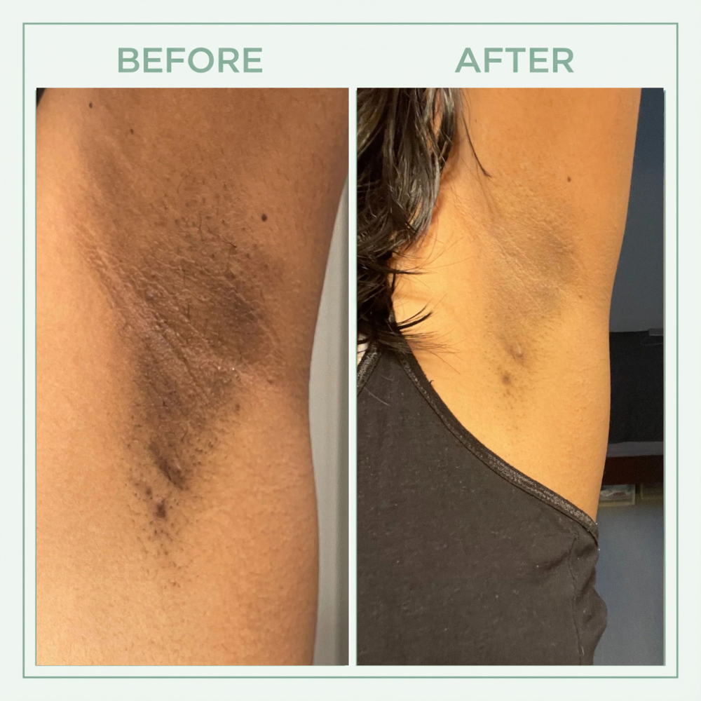 Valuethese™ Bright Peel Spray
