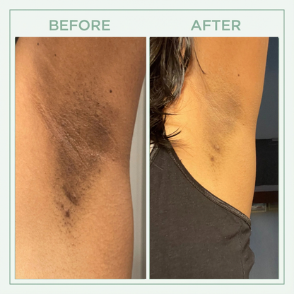 Valuethese™ Bright Peel Spray