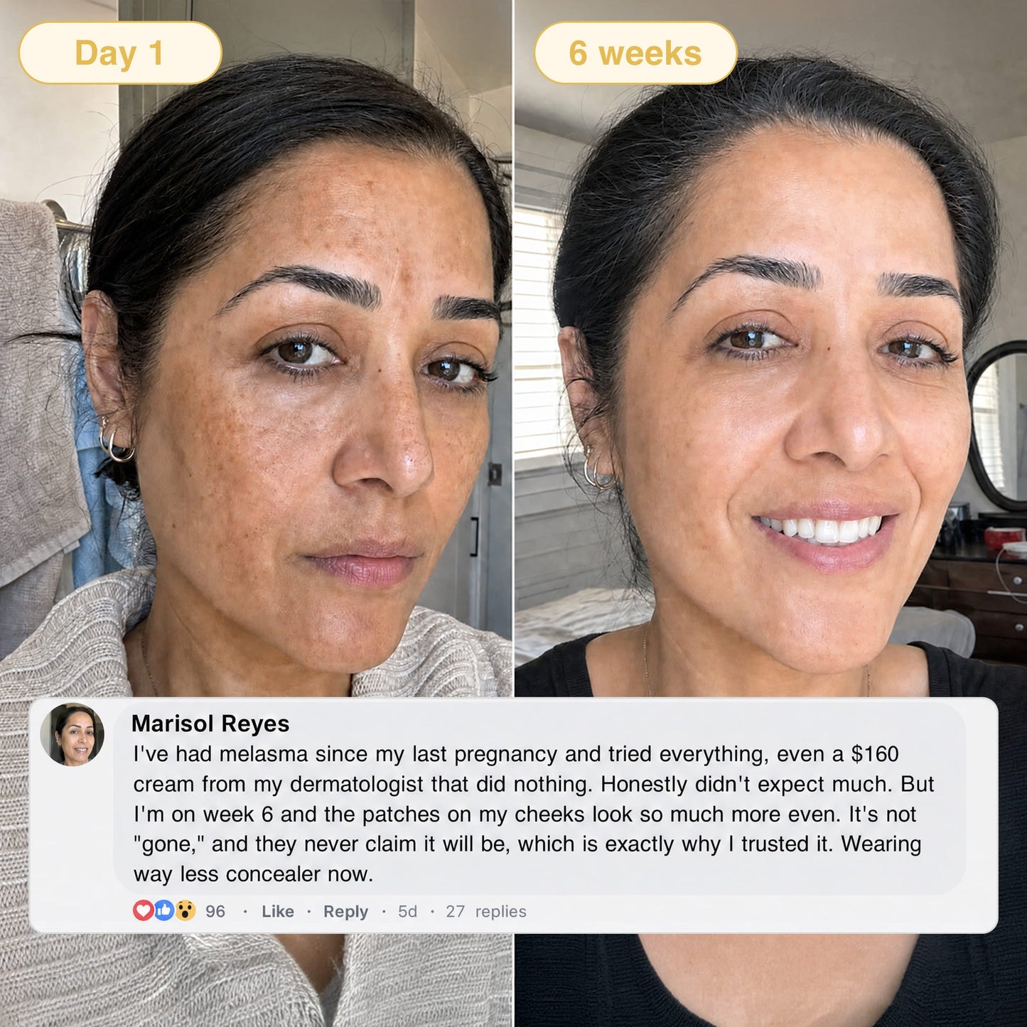 Valuethese Turmeric & Kojic Acid Overnight Mask