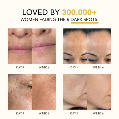 Valuethese Turmeric & Kojic Acid Overnight Mask