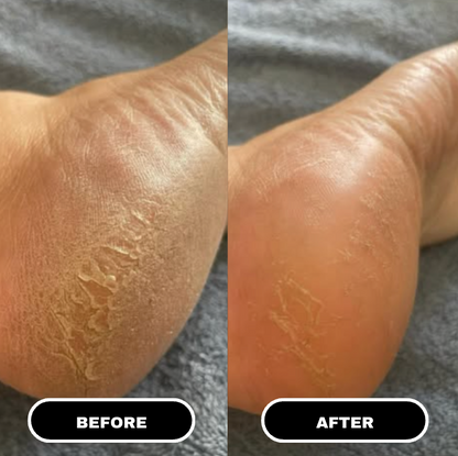 PureFoot Relief Stick — 2
