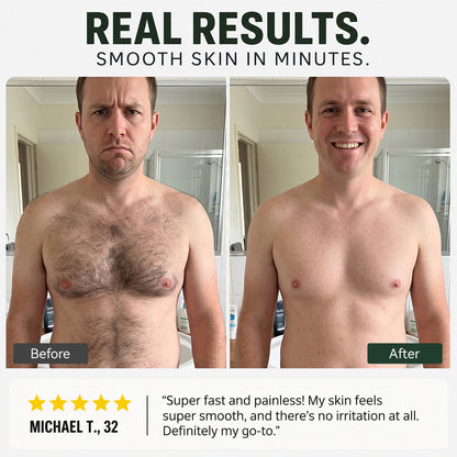 Valuethese  Hair Removal Cream