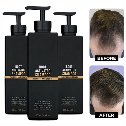Valuethese Root Activator Shampoo