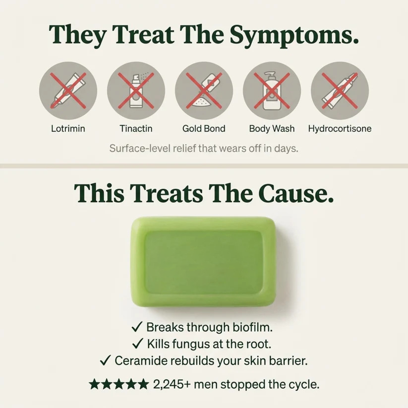 Tea Tree Antifungal Bar – Clears Fungal Infection and Skin Balance from the Root