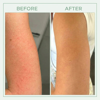 Valuethese™ Bright Peel Spray