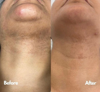 pcos-sync-eefe6371ed.jpg