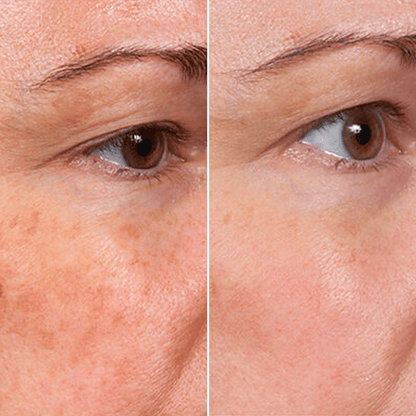 Valuethese Face Serum