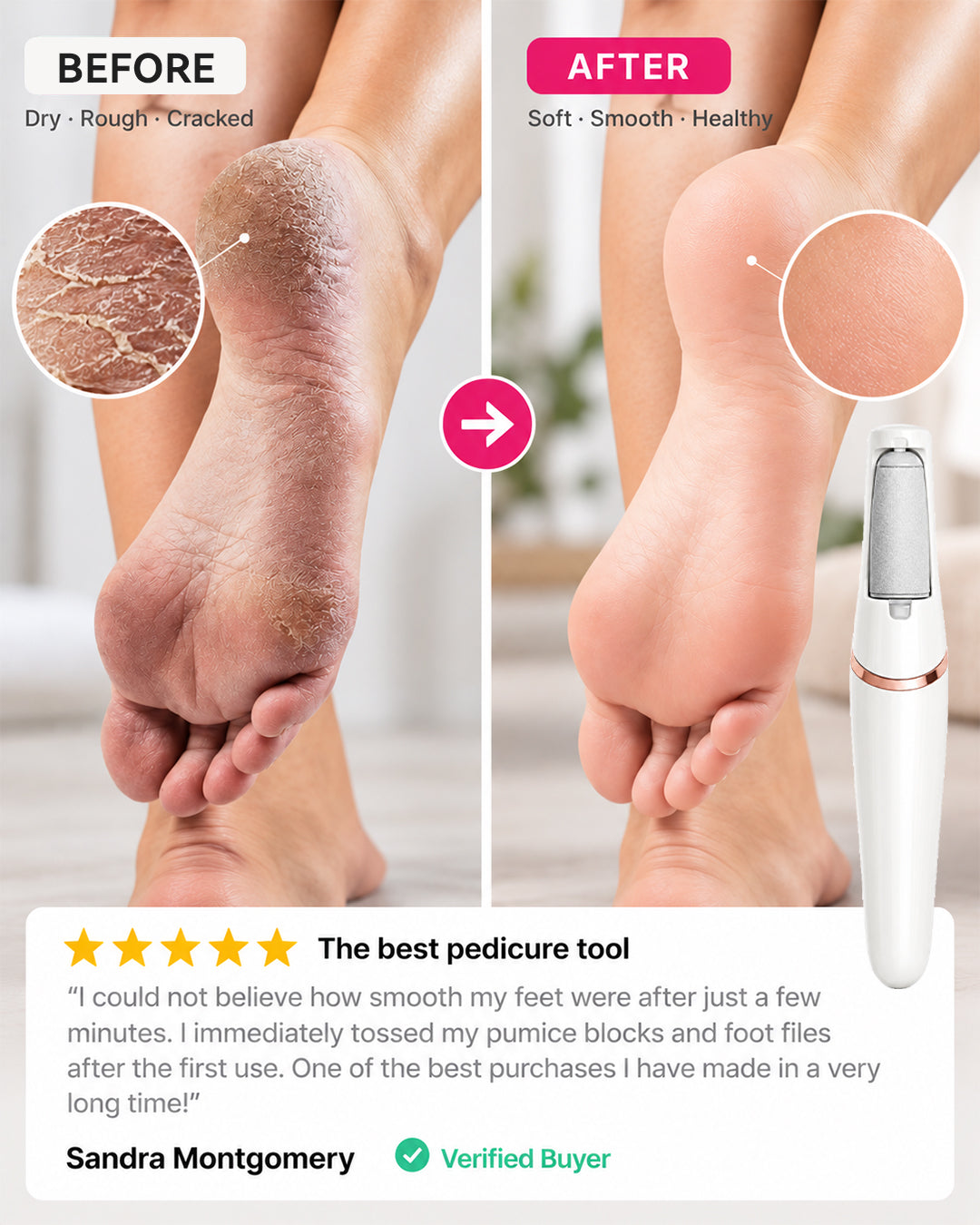 Valuethese Silk 3 Pro
